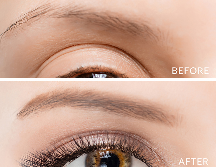 eyebrow serum before and after nanobrow